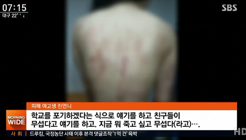 <SBS 뉴스 방송 영상 캡처>